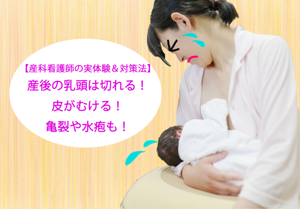 看護師が対策伝授 産後の乳首は切れる 皮がむける 亀裂や水疱も Mom Life Creation